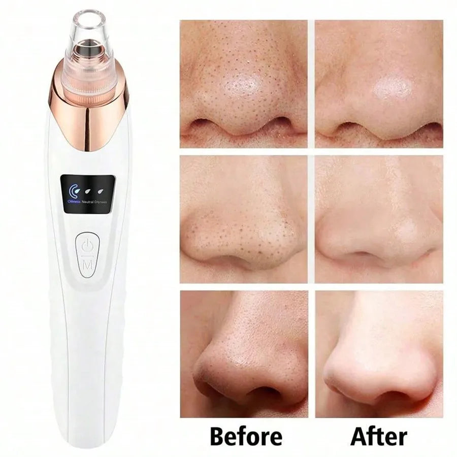 Electric Blackhead Remover