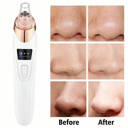 Electric Blackhead Remover