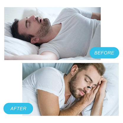 EZ Breathe Nose Strips