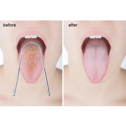 Steel Tongue Scraper