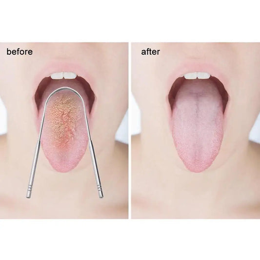 Steel Tongue Scraper